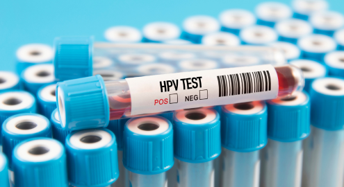 Your partner was diagnosed with HPV or genital warts