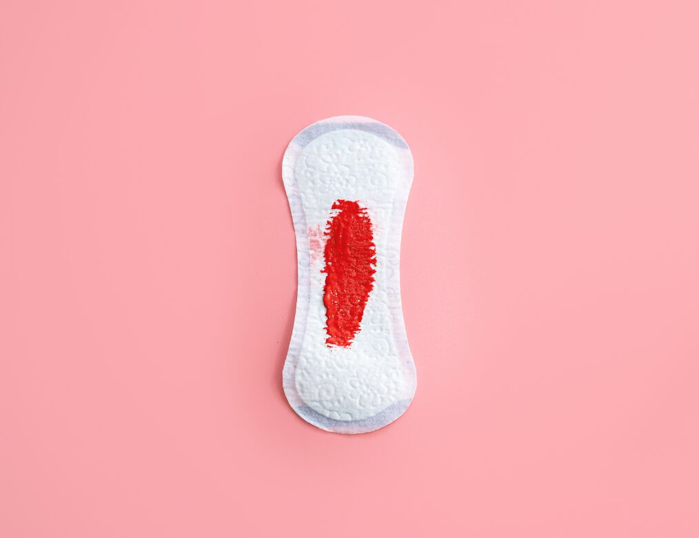 You experience bleeding between periods more than once