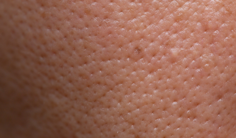 Pore and Texture Refinement