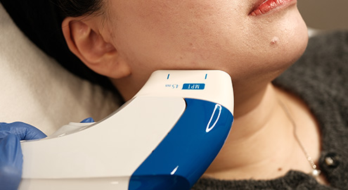 Procedure